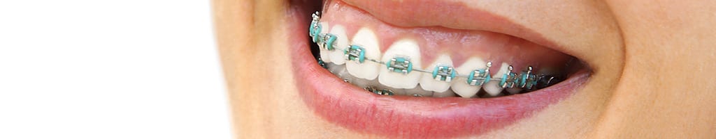 orthodontics