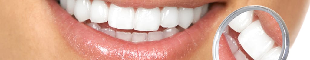 teeth whitening